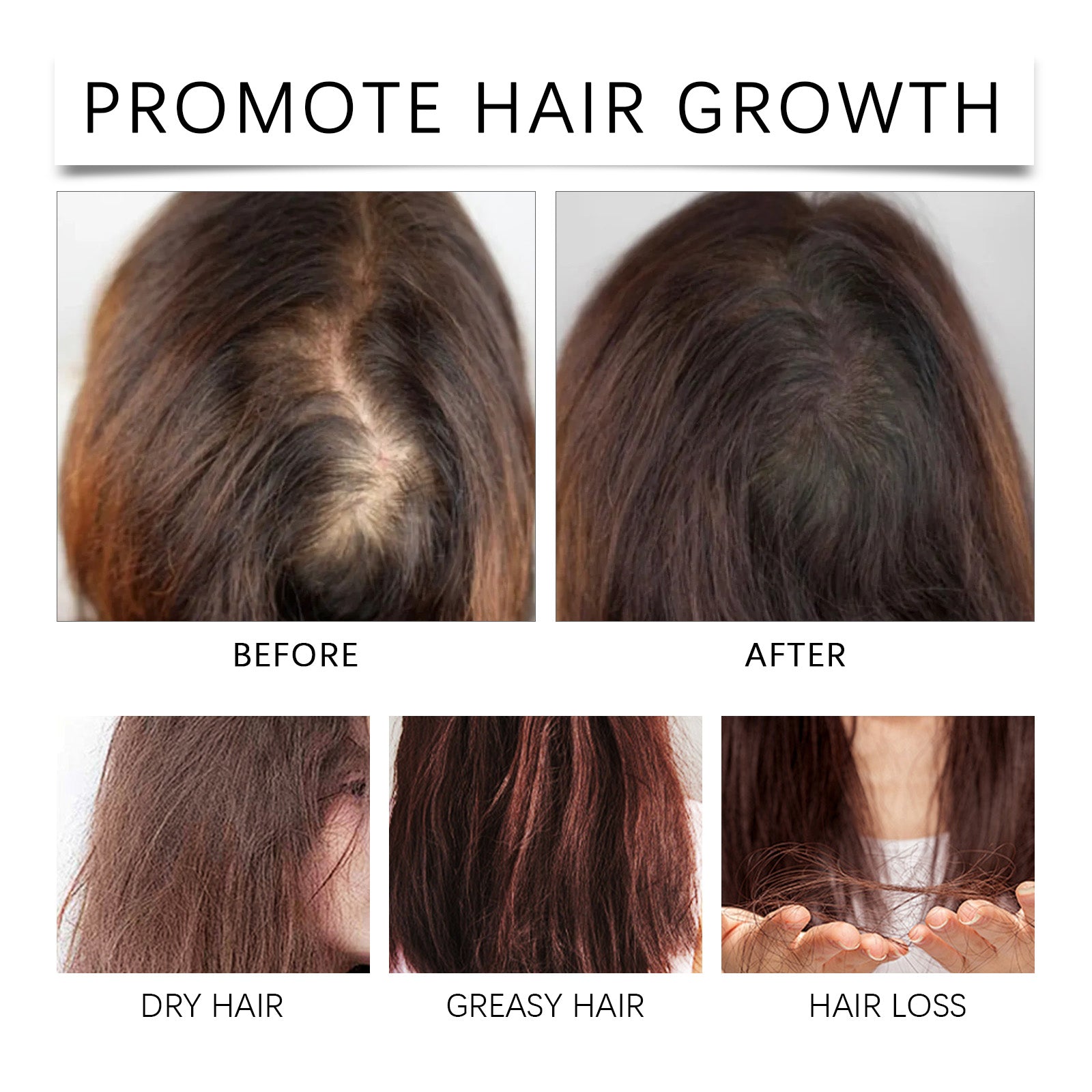 Palm Oil Hair Care Essence, Scalp Massage Treatment Repair Dry Hair, Soft And Solid Hair