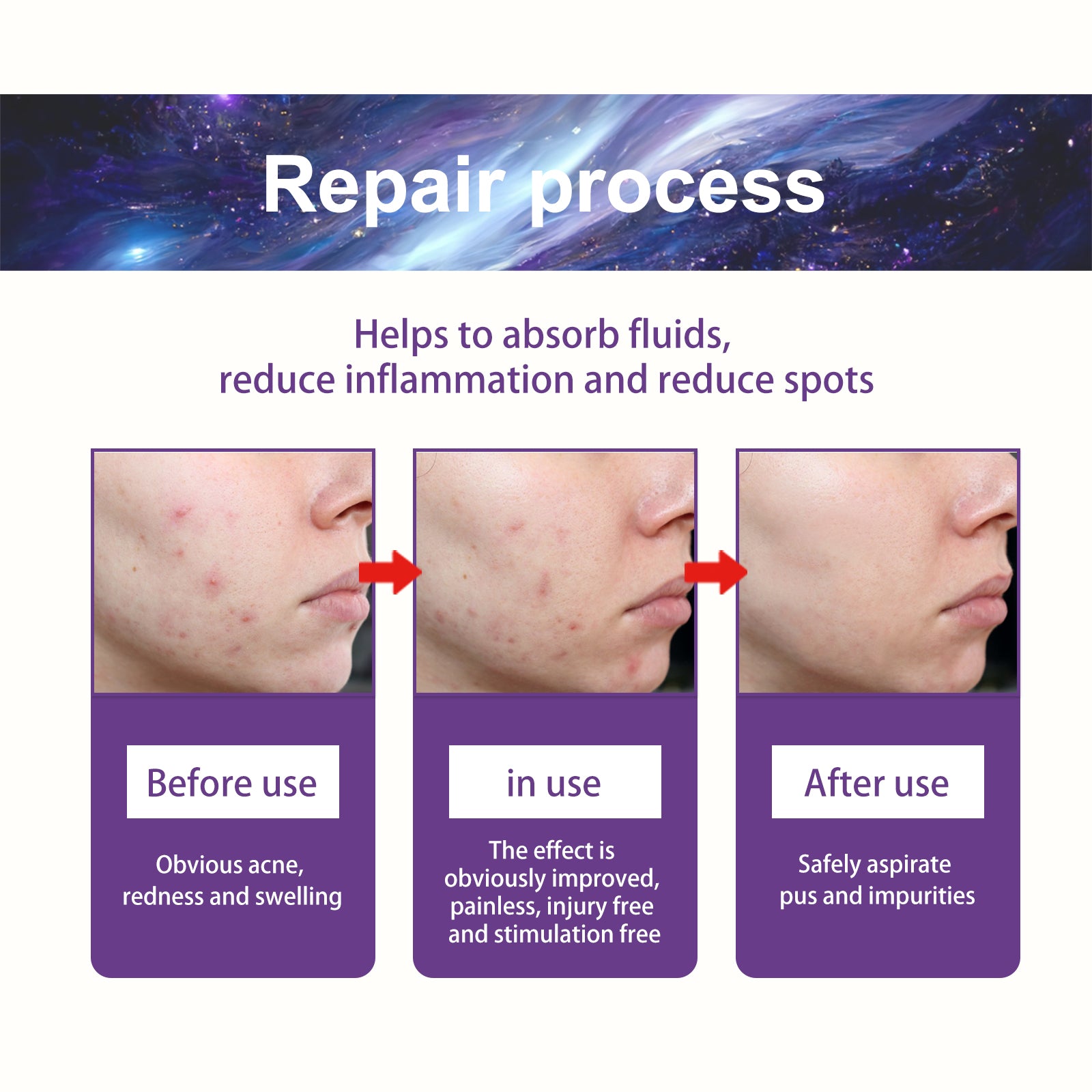 Acne Patch, Fade Closed Mouth Acne, Clear Acne, Waterproof Breathable Repair Acne Muscle Pattern Acne Patch