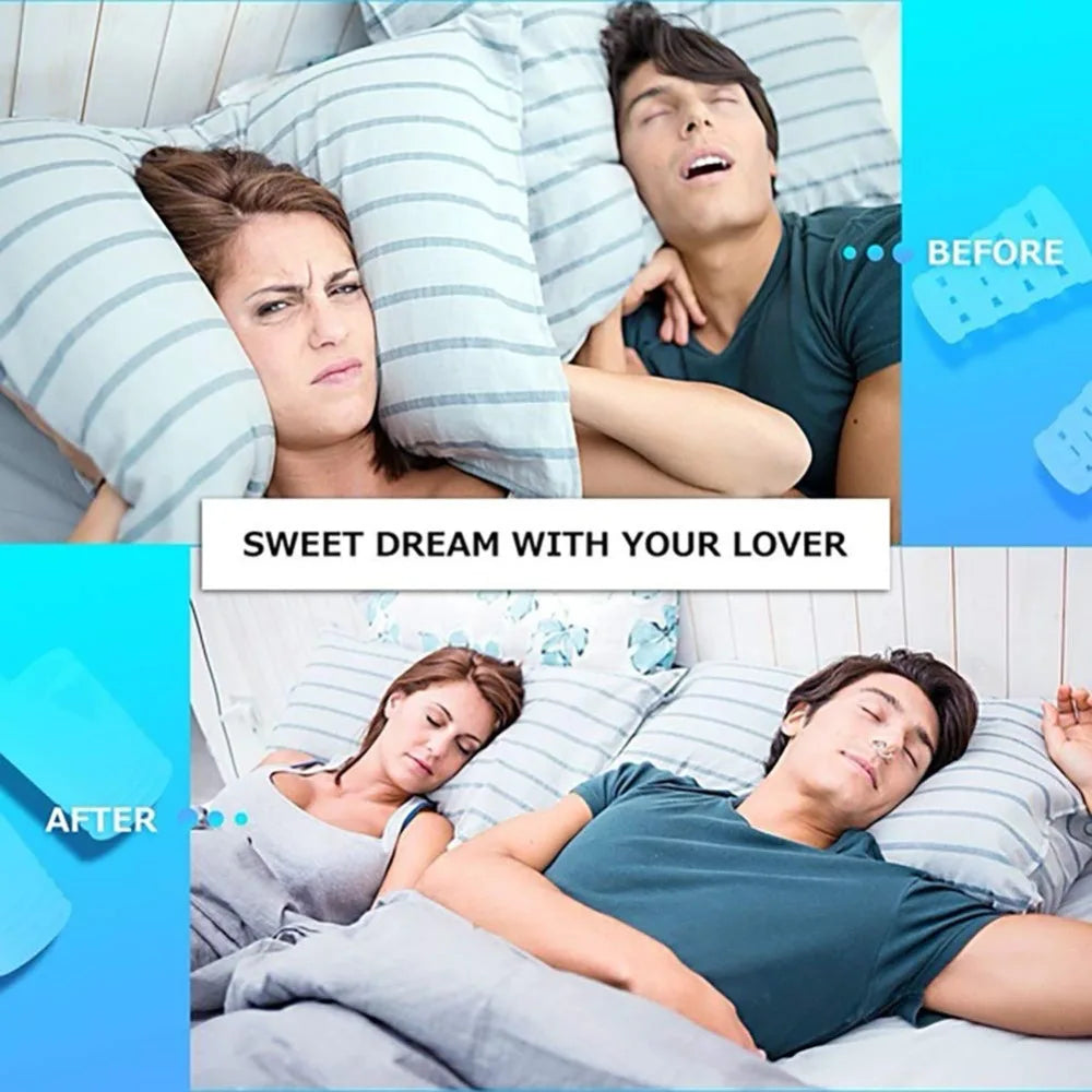 8PCS /set Snoring Solution Anti Snoring Devices Professional Snore Stopper Nose Vents Snore Nasal Dilators For Better Sleep