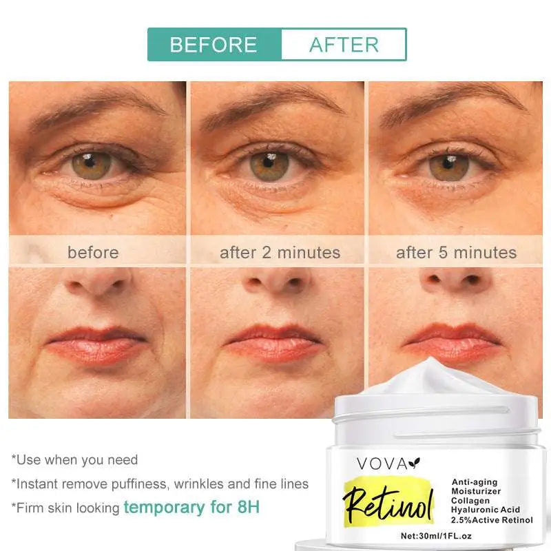 Retinol Anti-Aging Moisturizer Face Cream 30ml